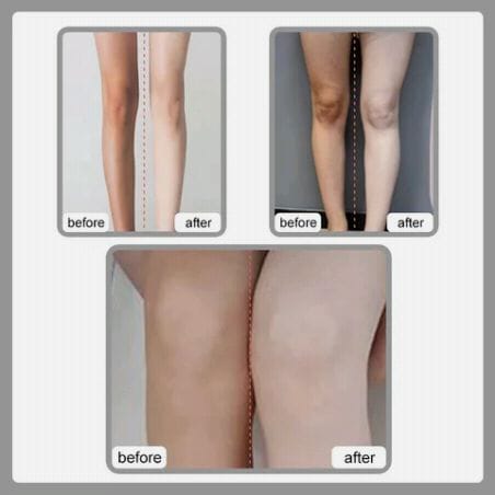 New Hair Removal Foaming Spray - Advance Formula with Refreshing Fragrance (200ml)